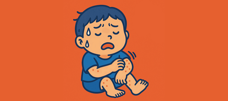 汗疹に悩む子供
